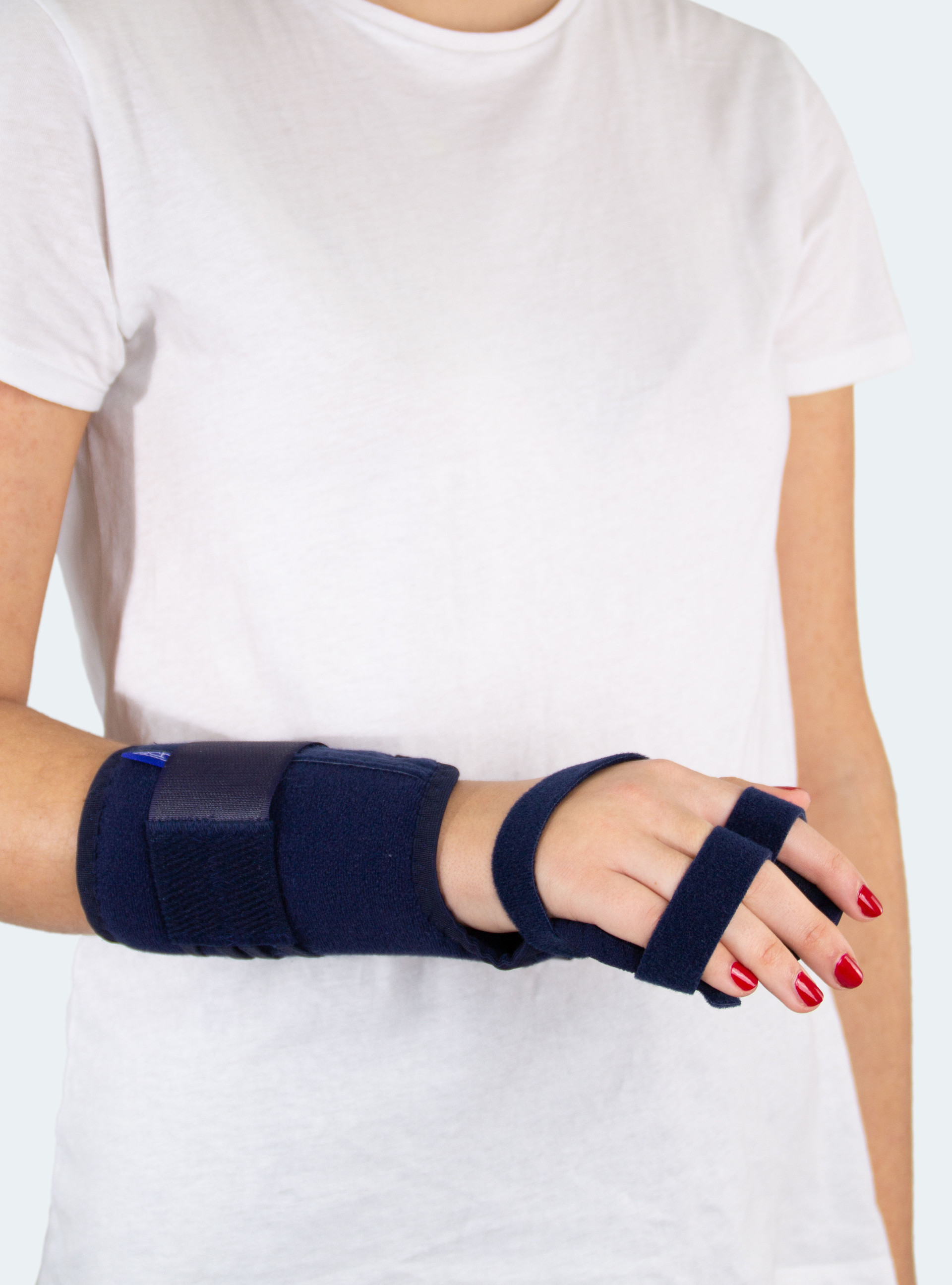 Para Carpal closed