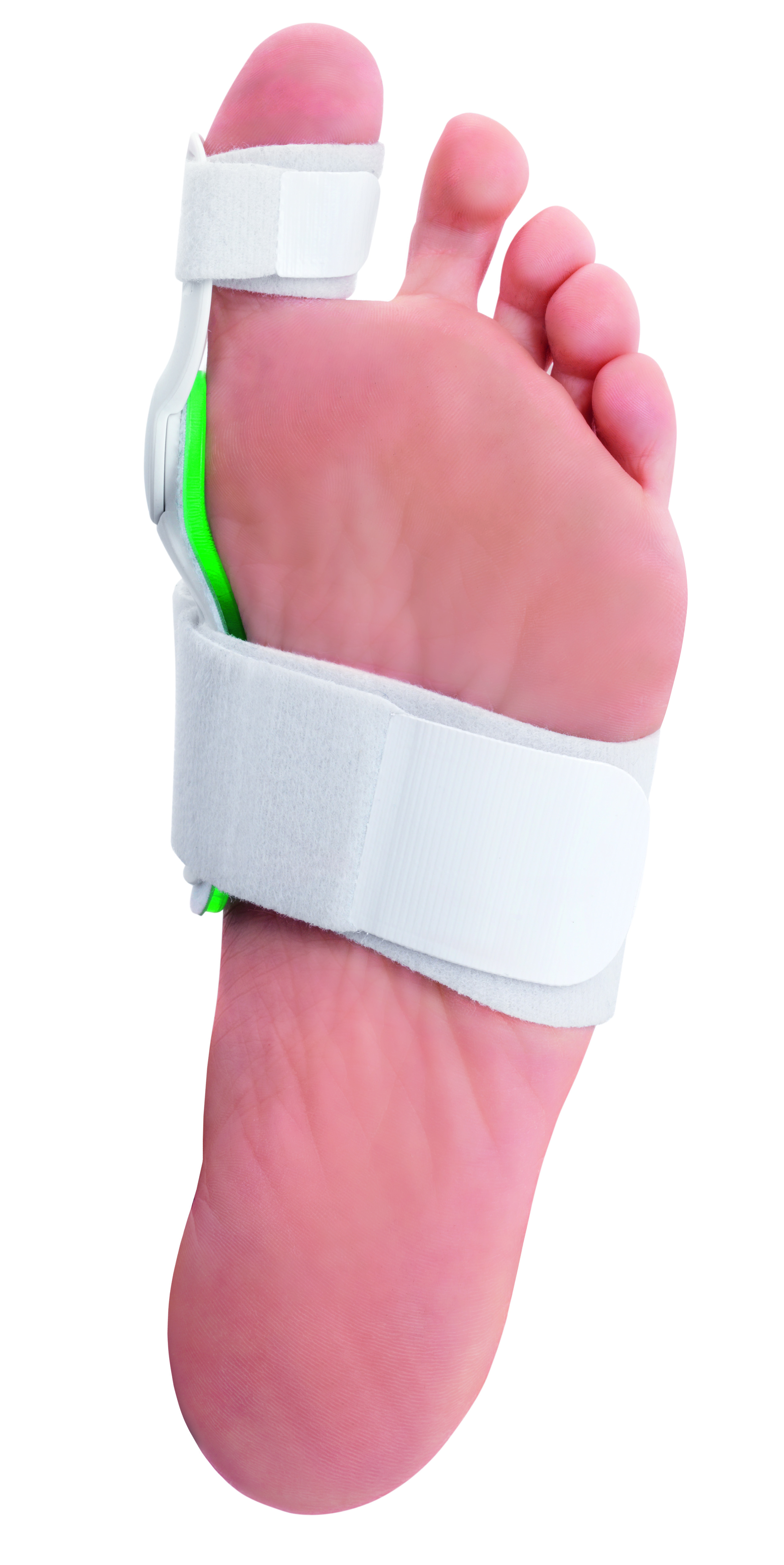 Hallux Valgus Splint (bunion splint)