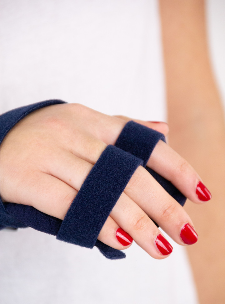 Para Carpal closed